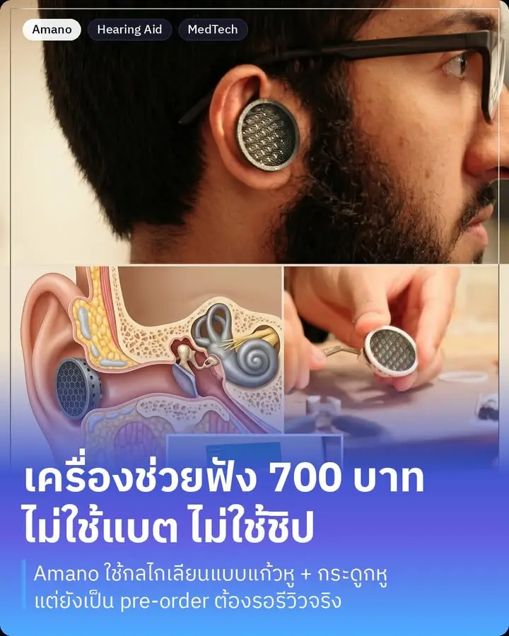 เครื่องช่วยฟังที่ราคาไม่ถึงพันบาท แต่ไอเดียคือเลียนแบบ “หูมนุษย์”…
