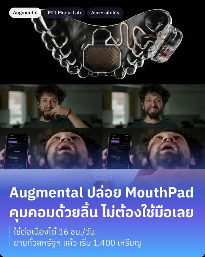 MouthPad คืออุปกรณ์อินพุตที่ควบคุมคอมพิวเตอร์ด้วยลิ้นครับ…