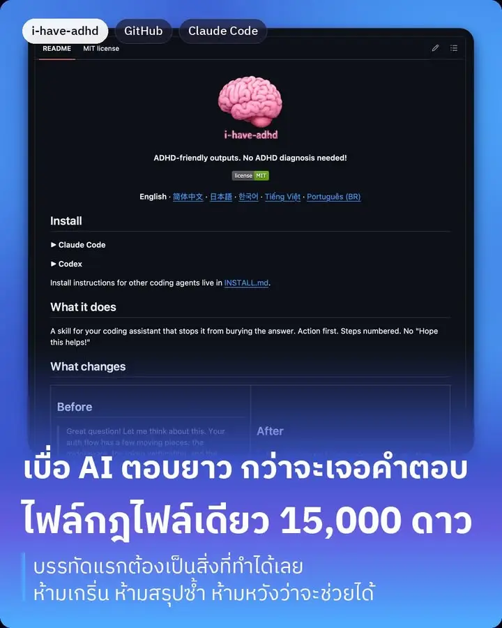 มี repo ชื่อ i-have-adhd บน GitHub ที่ได้ 15,335…